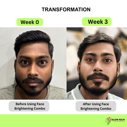 FACE BRIGHTENING COMBO - complete skincare routine